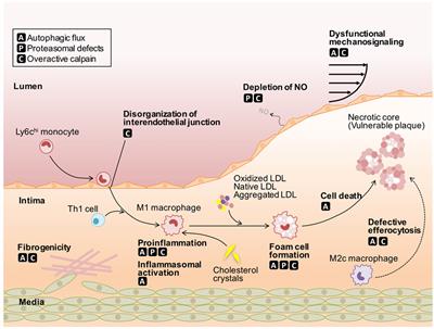 Defective <mark class="highlighted">Protein Catabolism</mark> in Atherosclerotic Vascular Inflammation